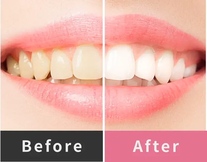 Before After